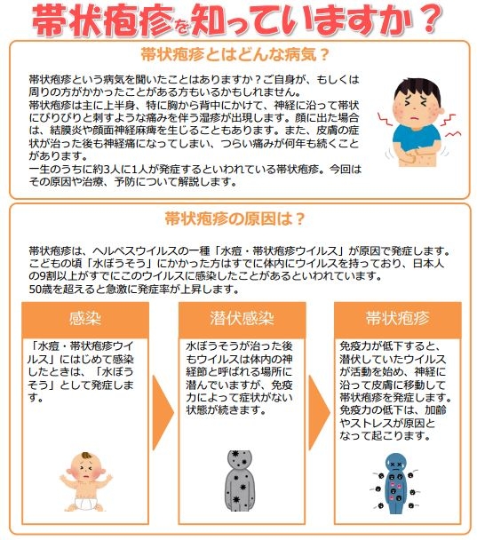 帯状疱疹